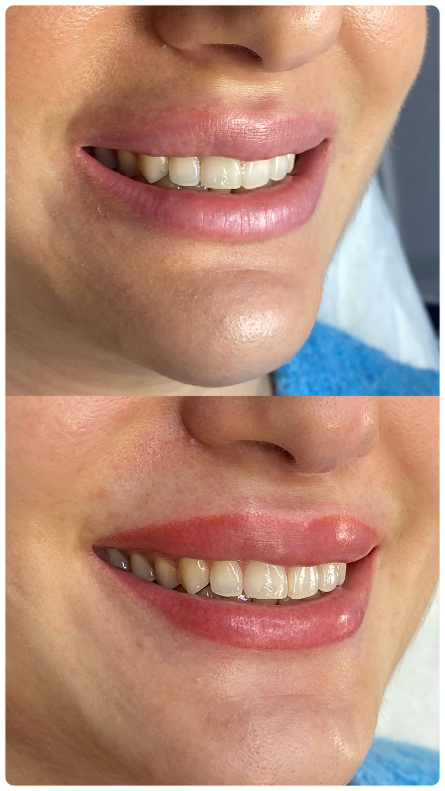 Permanent Makeup Lip Pigmentation