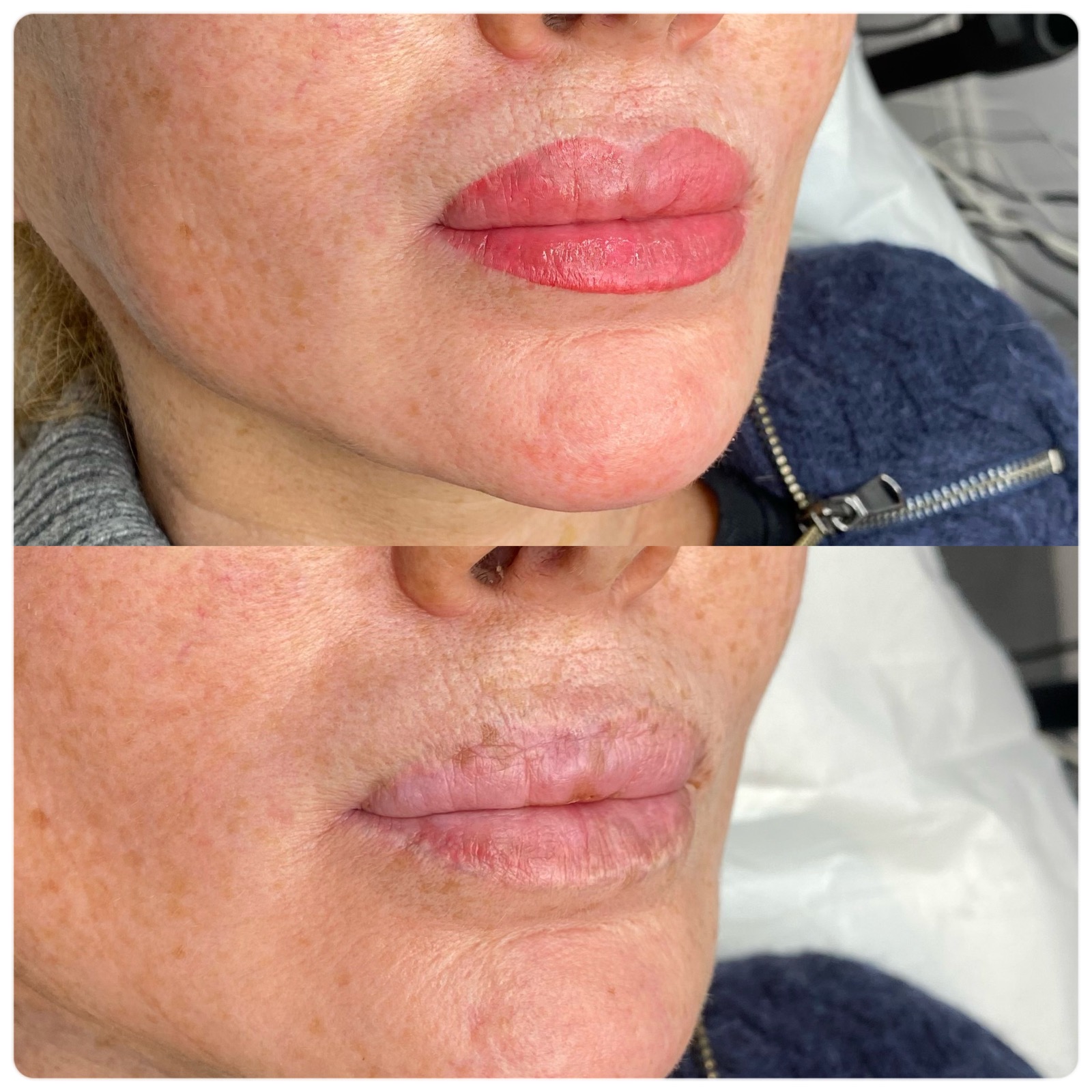 Permanent Makeup Lip Pigmentation